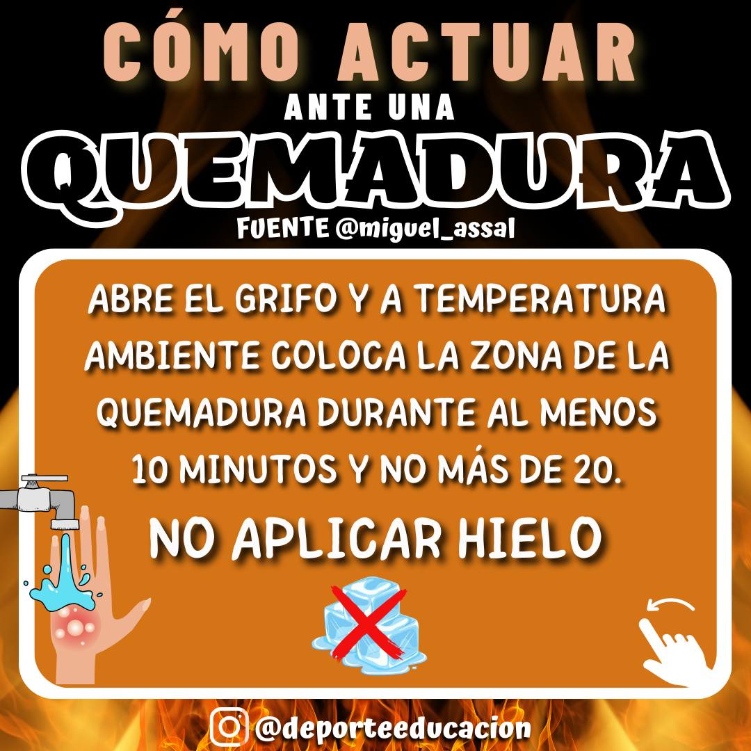 CÓMO ACTUAR ANTE QUEMADURAS DE PRIMER GRADO